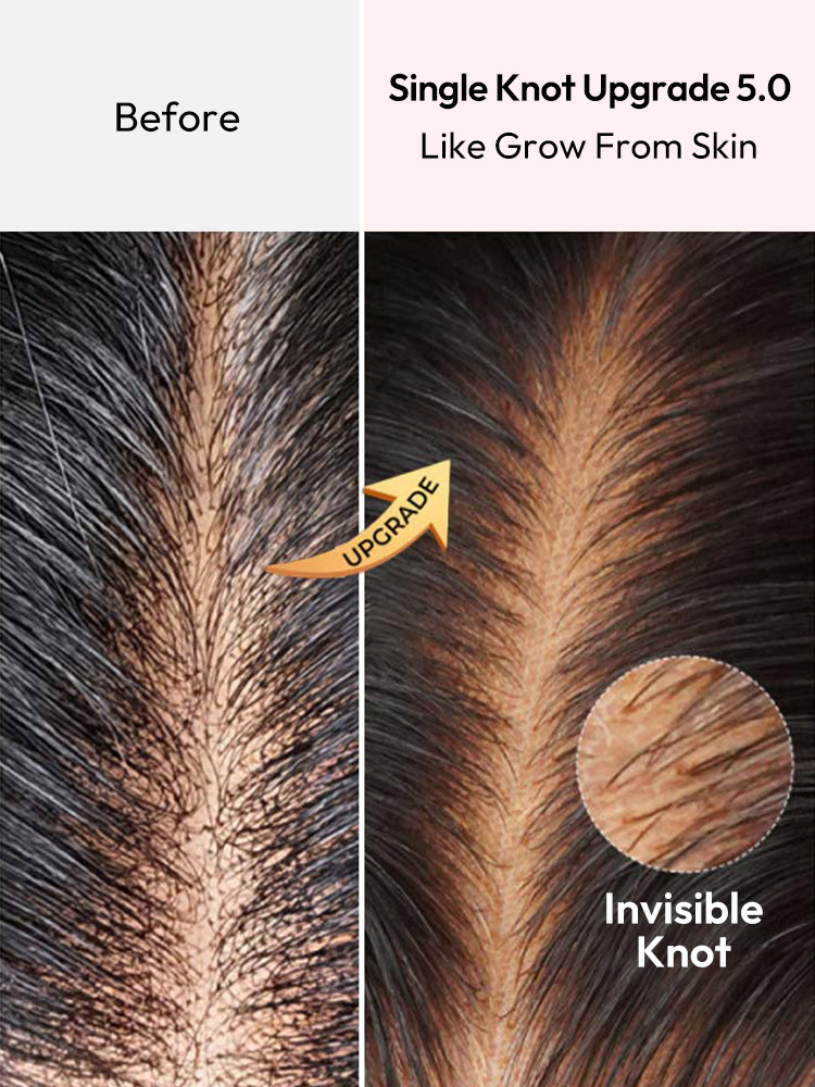 Upgrade Single Knots