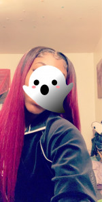  The hair came very quickly actually ...